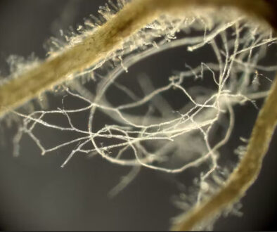 Mycorrhizal fungi growing with a plant root by Yoshihiro Kobae